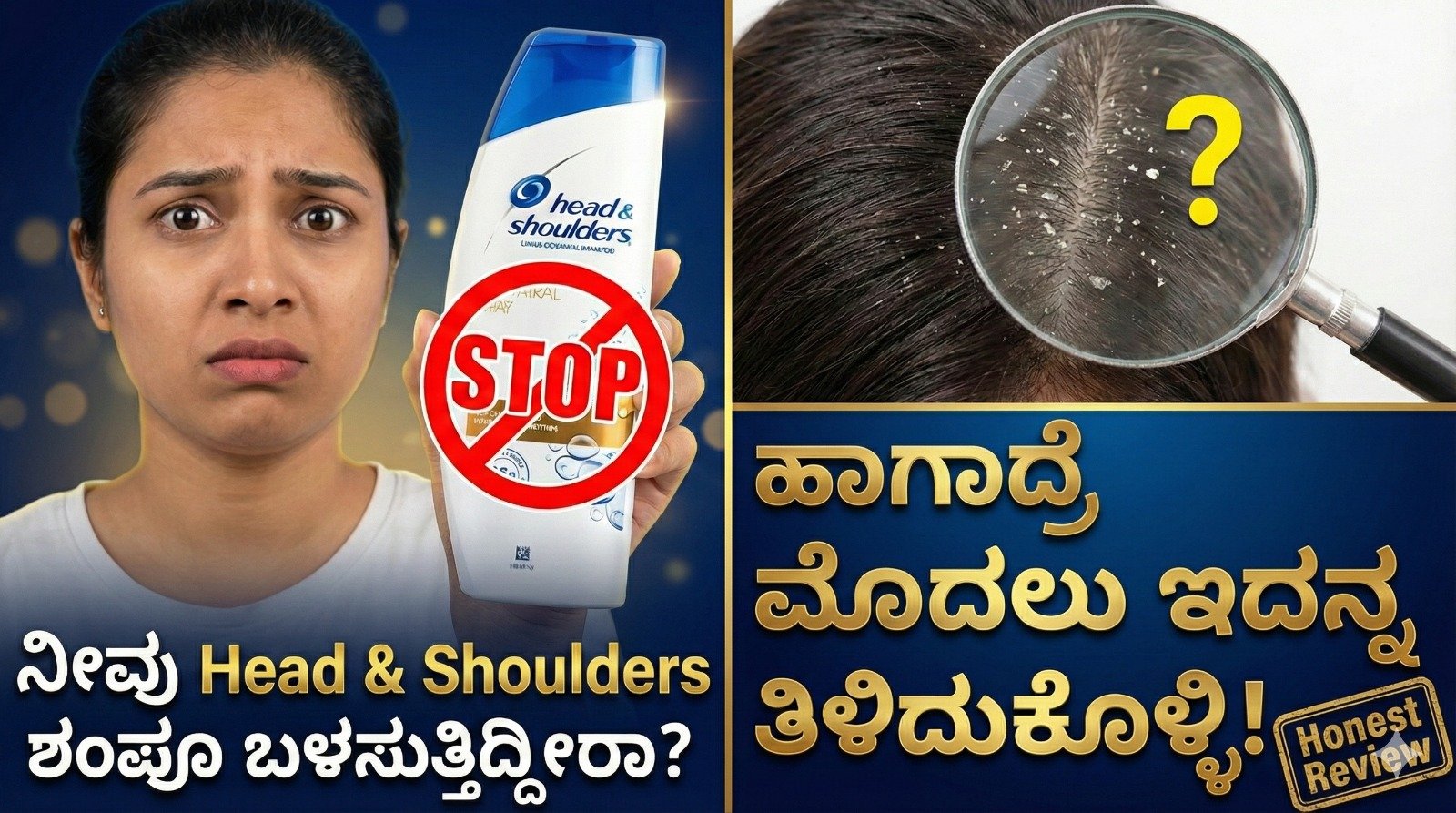head and shoulder anti dandruff shampoo review